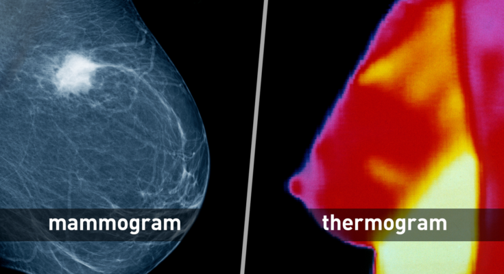 Breast Imaging Devices Market