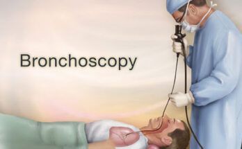 Bronchoscopy Market