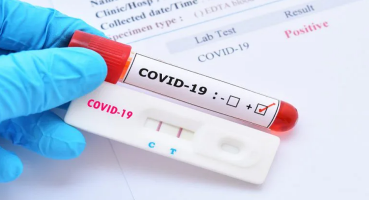 PCR And Realtime PCR Testing Market