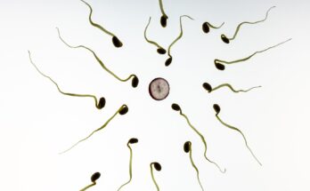 IVF Services Global Market