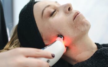 Dermatology Medical Lasers Market