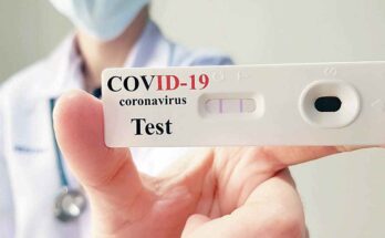 COVID-19 Rapid Test Kits Market