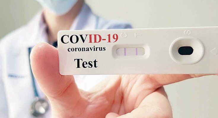 COVID-19 Rapid Test Kits Market