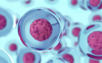 Stem Cell Therapy Global Market