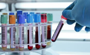 oncology molecular diagnostics market