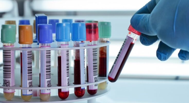 oncology molecular diagnostics market