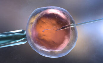 IVF services market