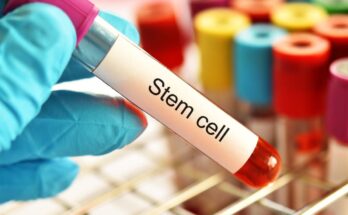 stem cell/cord blood banking market