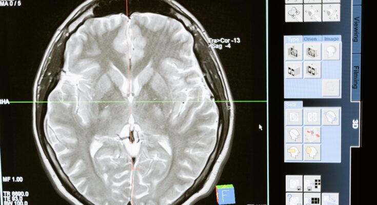 3D Medical Imaging Devices Global Market