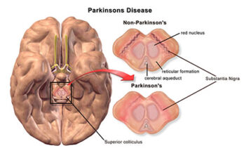 Anti-Parkinson Drugs