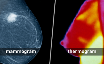 Breast Imaging Devices Market