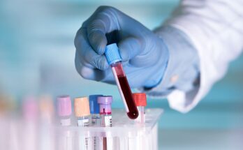 Liquid Biopsy Market