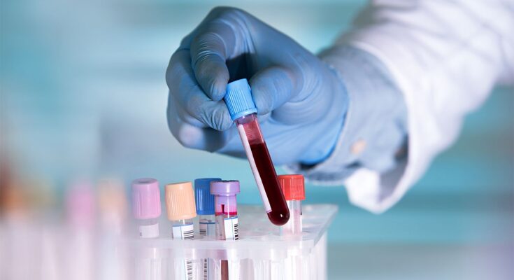 Liquid Biopsy Market