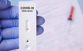 COVID-19 rapid test kits market