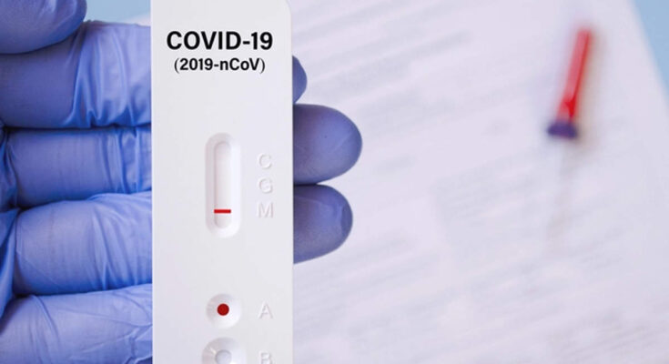 COVID-19 rapid test kits market