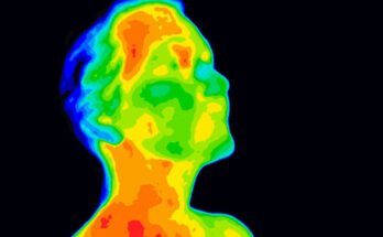 Thermal Imaging Market