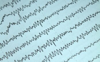 electrophysiology devices and equipment market