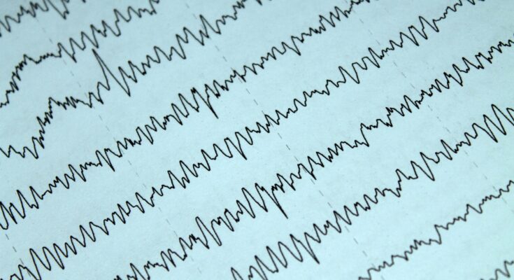 electrophysiology devices and equipment market