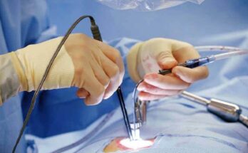 gynecology medical lasers market