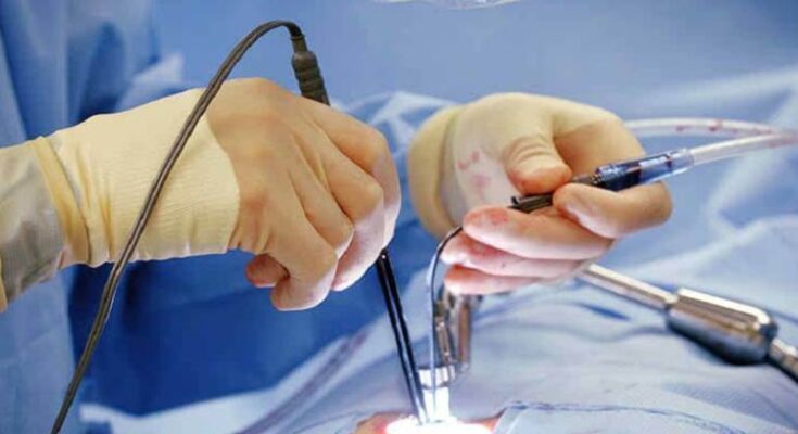 gynecology medical lasers market