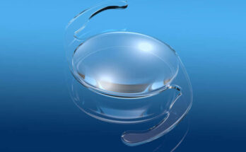 Intraocular Lens