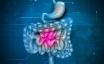 Gastrointestinal Drugs Market