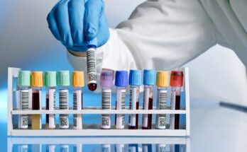 Cancer Diagnostics Market