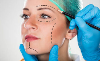 cosmetic surgery market