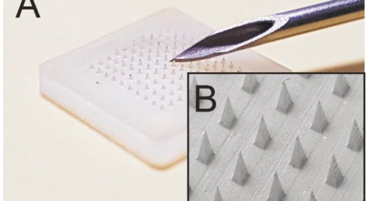 microneedle drug delivery systems market segmentation