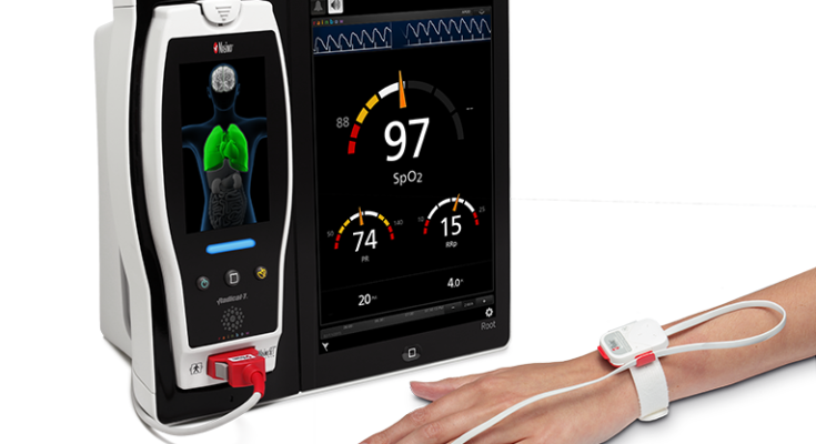 respiratory monitoring devices market segmentation