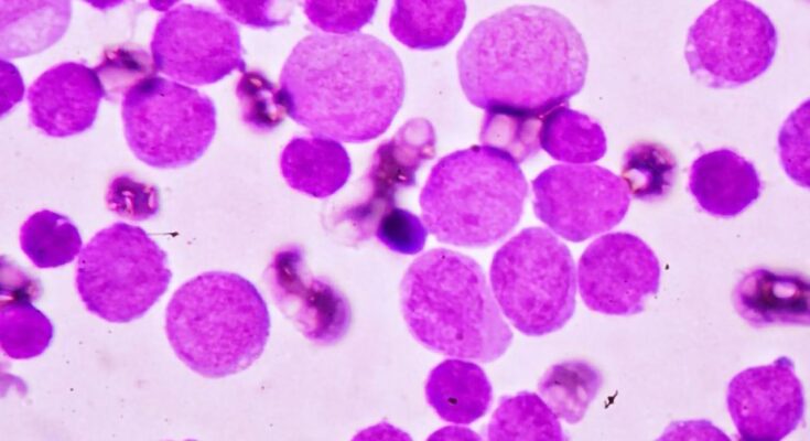 acute myeloid leukemia market segmentation