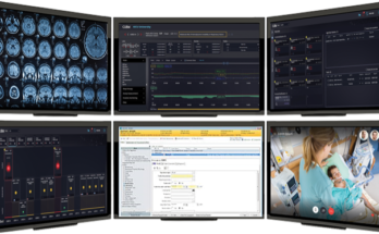 tele-intensive care market segmentation