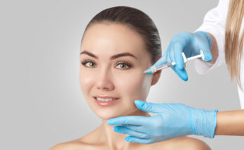 hyaluronic acid-based dermal fillers market