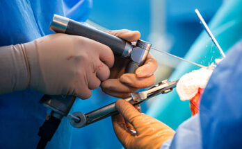 orthopedic regenerative surgical products market