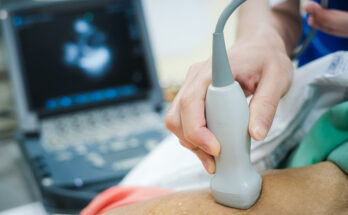 ultrasound devices and equipment market