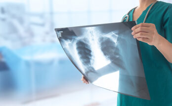 radiology as a service market