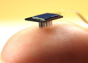 Global Microelectronic Medical Implants Market