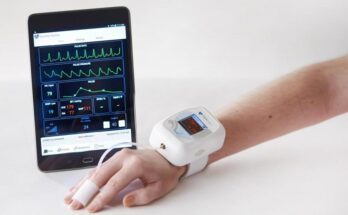 Global Patient Fluid Status Monitor Device Market