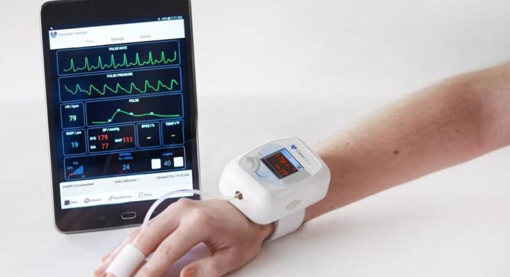 Global Patient Fluid Status Monitor Device Market