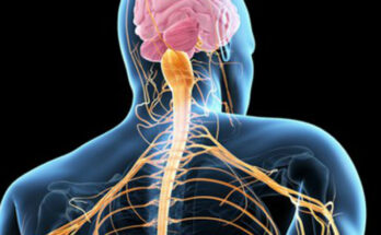 Amyotrophic Lateral Sclerosis (ALS)