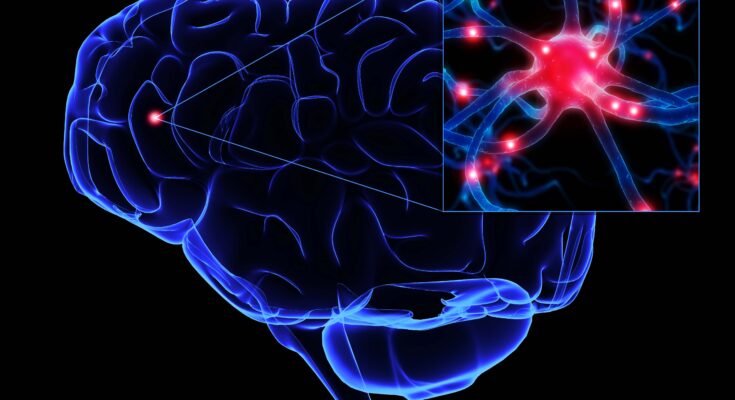 Global Brain Stroke Market