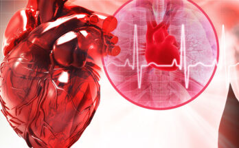 Cardiac Rhythm Management Systems