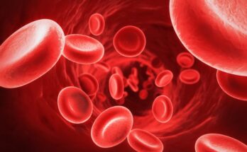 Colloids (Blood Plasma) Market