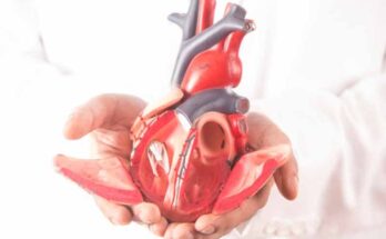 Congenital Heart Disease Occluder Market