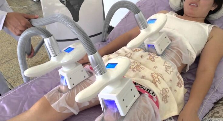 Cryolipolysis Machine Market