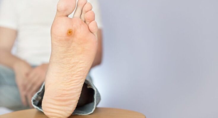 Diabetic Foot Ulcers and Pressure Ulcers