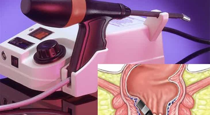 Gynecology Lasers Market