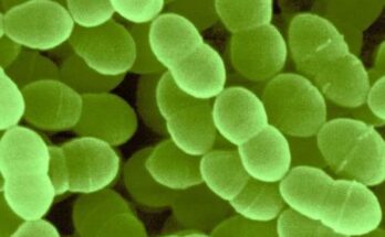 Streptococcus Thermophiles Market