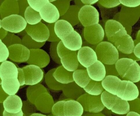 Streptococcus Thermophiles Market