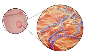 Syphilis Diagnosis Market